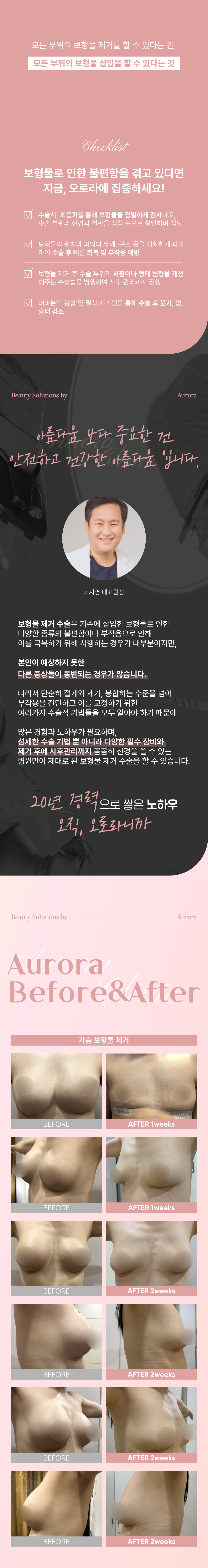 - 오로라의원은 초음파 장비를 사전검사 시 사용하는 것 뿐 아니라, 시술하면서도 초음파장비를 사용하여 보형물 제거 부작용을 완화하고 환자의 만족도를 높이려고 노력합니다.
- 모든 부위의 보형물을 제거 할 줄 안다는 것은 모든 부위에 보형물을 삽입할 수 있다는 것, 즉 전체적인 부위에 대한 수술 이해도가 있어야 진행할 수 있는 것으로 기술과 경험이 많아야 합니다.
- 수술 후 흉터를 완화하기 위해 다양한 봉합기술 사용합니다.