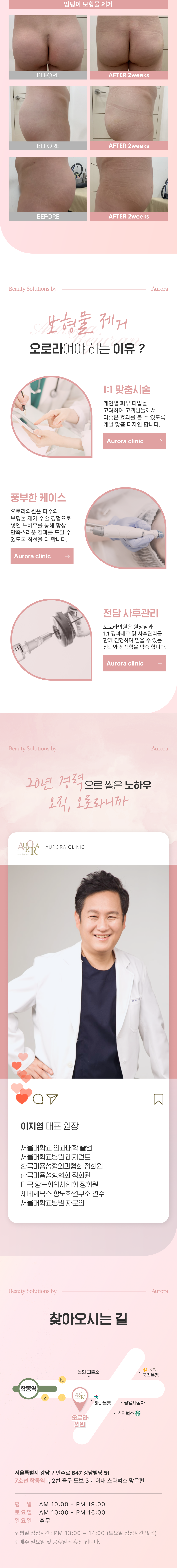 - 오로라의원은 초음파 장비를 사전검사 시 사용하는 것 뿐 아니라, 시술하면서도 초음파장비를 사용하여 보형물 제거 부작용을 완화하고 환자의 만족도를 높이려고 노력합니다.
- 모든 부위의 보형물을 제거 할 줄 안다는 것은 모든 부위에 보형물을 삽입할 수 있다는 것, 즉 전체적인 부위에 대한 수술 이해도가 있어야 진행할 수 있는 것으로 기술과 경험이 많아야 합니다.
- 수술 후 흉터를 완화하기 위해 다양한 봉합기술 사용합니다.