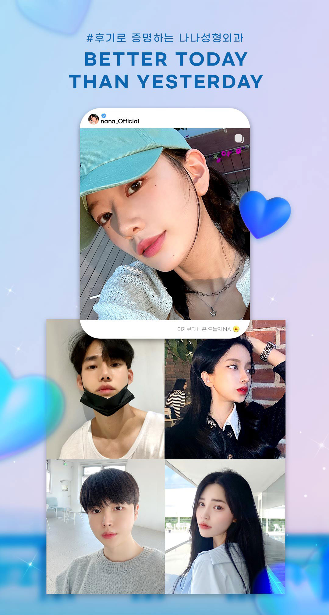 콧대부터 코끝까지 매력적인 나나 코성형