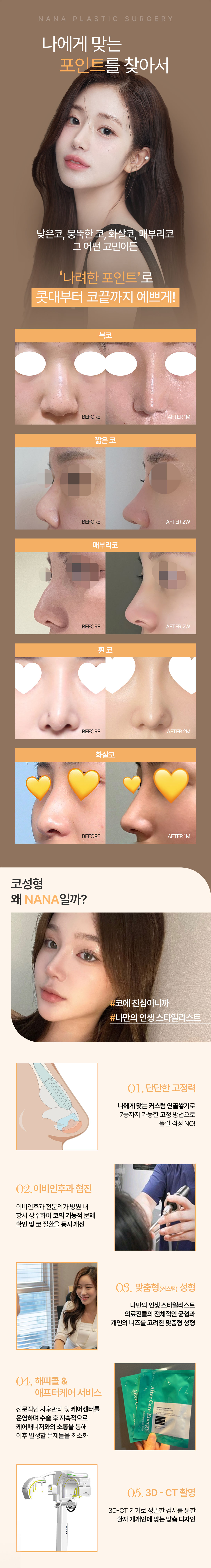 콧대부터 코끝까지 매력적인 나나 코성형