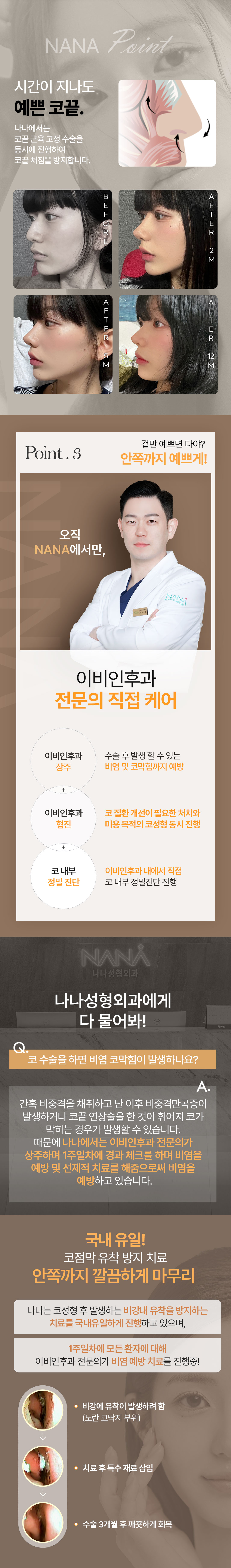 콧대부터 코끝까지 매력적인 나나 코성형