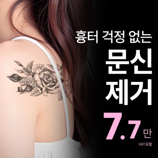 송도비앤미 피코문신제거