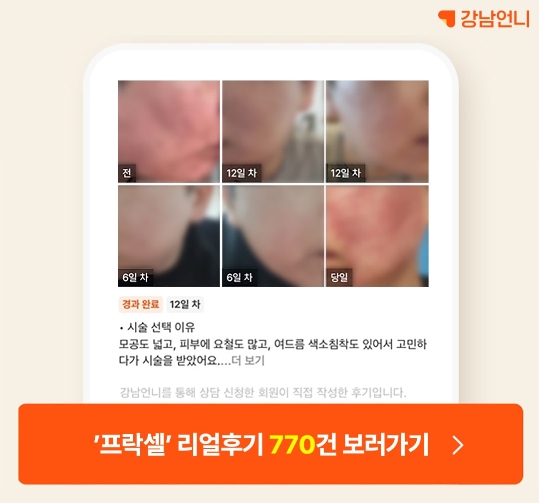 프락셀 전후 후기