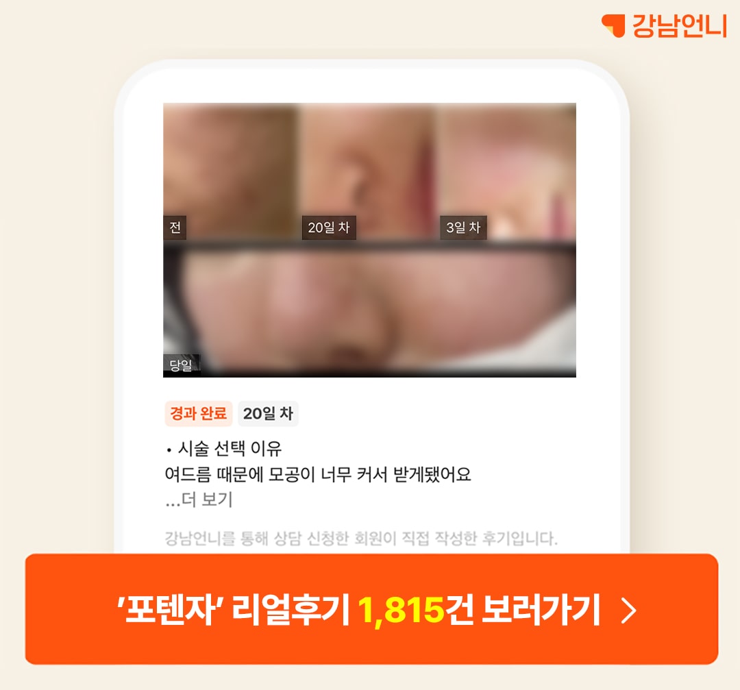 포텐자 전후 후기