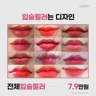 전체입술필러 U