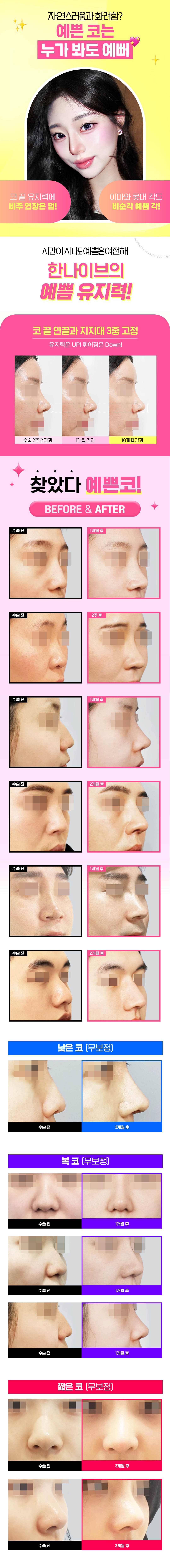 한나이브성형외과
- 분야별 성형외과전문의 5인
- 여성 마취통증의학과전문의 상주 및 케어
- 3D-CT 및 이비인후과 내시경 술전 검진
- 1:1 맞춤 3D 코보형물(핏미) 제작
- 염증 예방 고압산소챔버 회복 치료
- 전 수술방 CCTV 설치 및 실시간 녹화
- 호텔급 회복실 및 입원실 보유 (보건소 등록)
- 고객 전용 초대형 주차장 완비 (내원고객 한정 무료)
- 개인 발렛파킹 시스템 등 고객 편의 중점