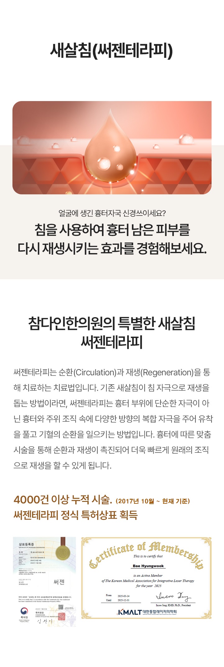 얼굴에 생긴 패인 흉터에 내 살을 재생시켜 채워 올리는 흉터침 시술. 첫방문 최대 2개까지 1회 체험해 볼 수 있는 기회. 한번의 시술로도 차이를 느낄 수 있습니다.