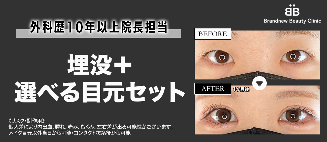 激安直営店 埋没（6点線留め・自然癒着法・裏留め◎）＋目頭・目尻切開・下 入浴剤・バスソルト