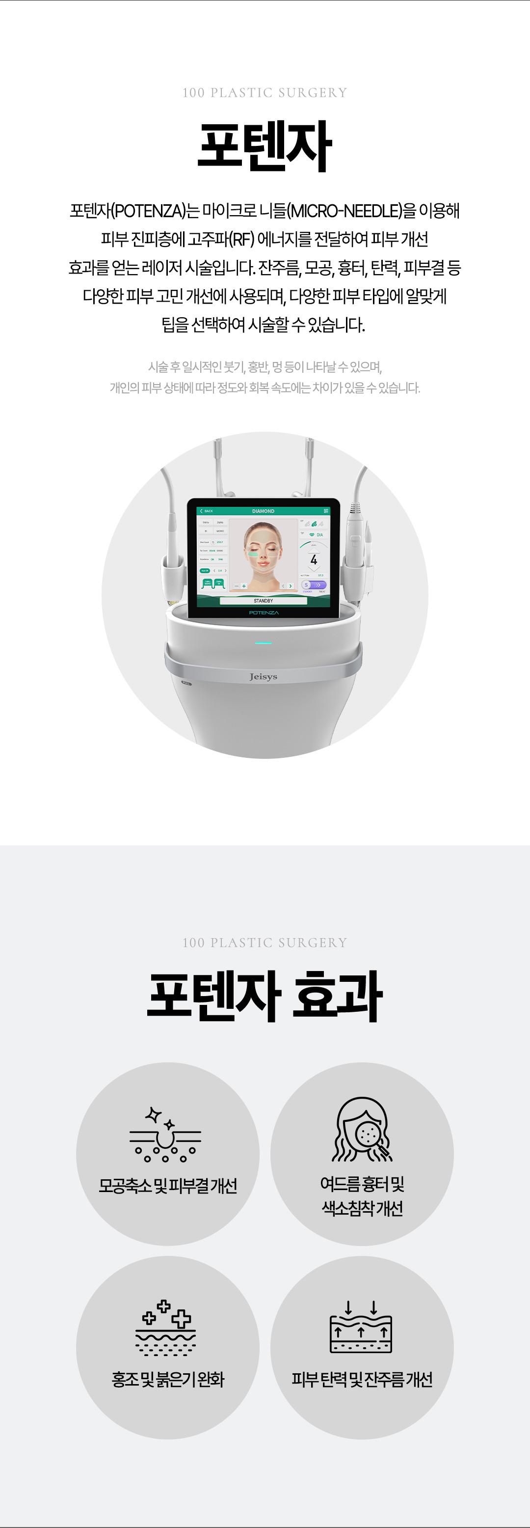 포텐자는 미세 절연 마이크로니들을 피부에 삽입한 뒤, 고주파(RF)를 전달해 피부 속 진피층을 자극하는 방식입니다. 열 에너지가 콜라겐과 엘라스틴 생성을 유도해 피부 재생을 유도하며, 절연침 덕분에 표피 손상은 최소화됩니다.
모공 축소, 여드름 및 여드름흉터 개선, 탄력 개선 및 잔주름 완화, 피부결 정리 및 재생 촉진에 효과가 있습니다.