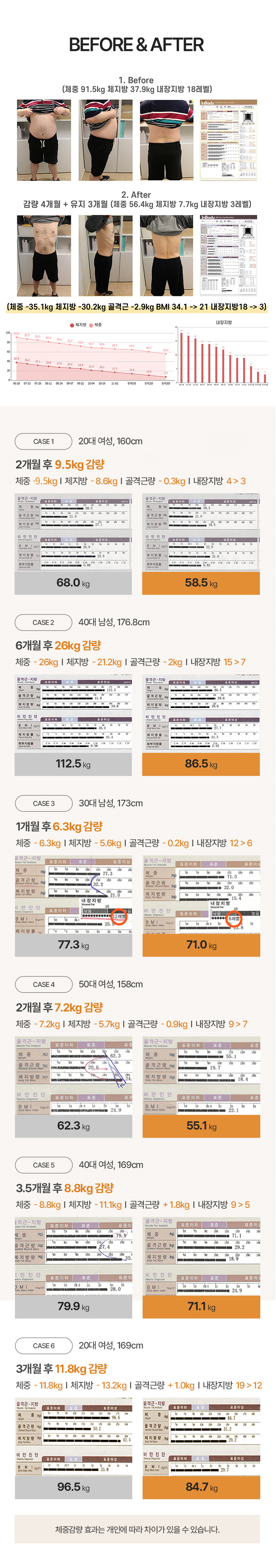 1. 투핏, 심플환, 리셋탕
하루 2번 한약복용으로 식이조절과 운동효과를 동시에 잡는,
건강하고 효과적인 한약 다이어트
2. 바디라인매선
지방층에 생분해성 흡수실(특수제작 PDO,polydioxanone 봉합사)을 자입하는 시술.
실의 지방층 자극 효과로 지방층의 두께감소, 국소 부위 라인정리에 효과적인 시술
3. 라인 약침
천연유래 지방분해 약침으로, 순환력이 떨어져 체지방이 축적된 부위의 대사를 촉진시켜 체지방분해를 돕는 천연 지방분해 시술.
