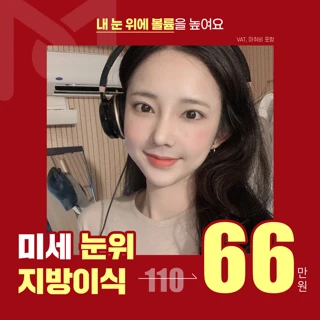 메이트 미세눈위지방이식