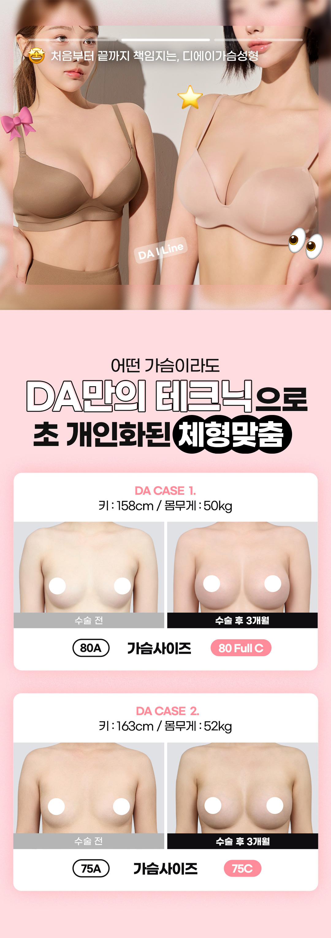 당일퇴원-모양, 촉감, 안전성 3가지의 가슴 Keynote를 찾다.