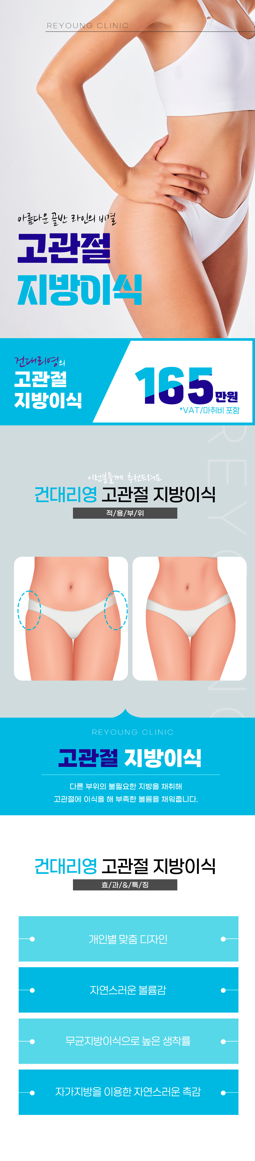 볼륨감 넘치는 아름다운 골반라인 고관절 지방이식