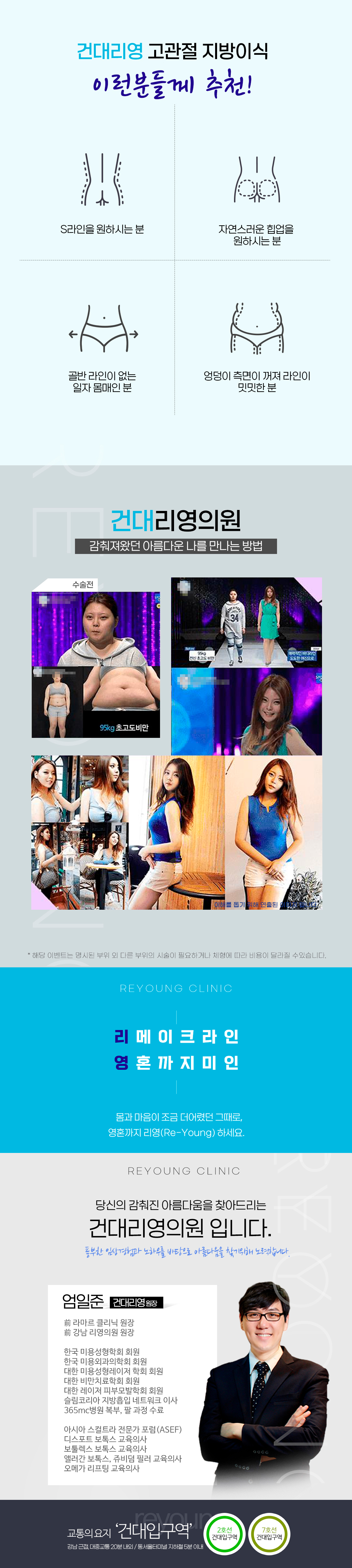 볼륨감 넘치는 아름다운 골반라인 고관절 지방이식