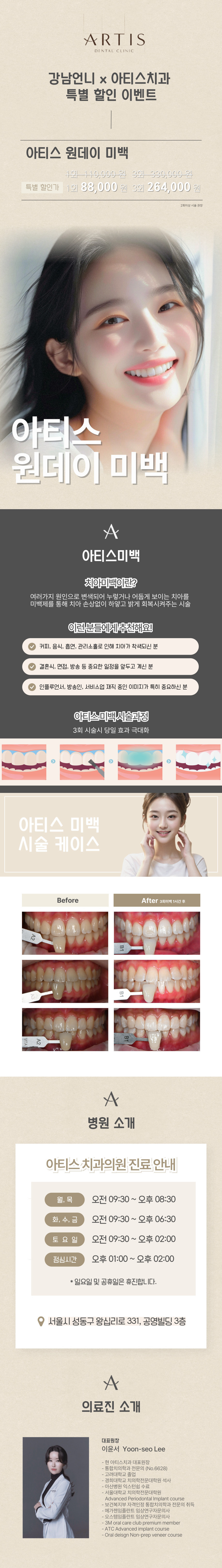 방문 당일 바로 효과를 확인할 수 있는 아티스 치아 미백 시술입니다.