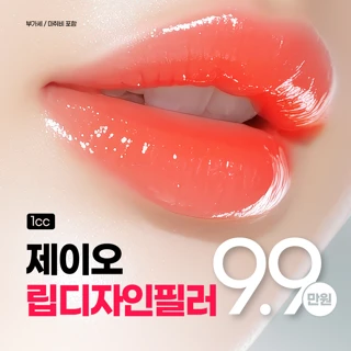 부산 입술필러_뉴라미스,제이오