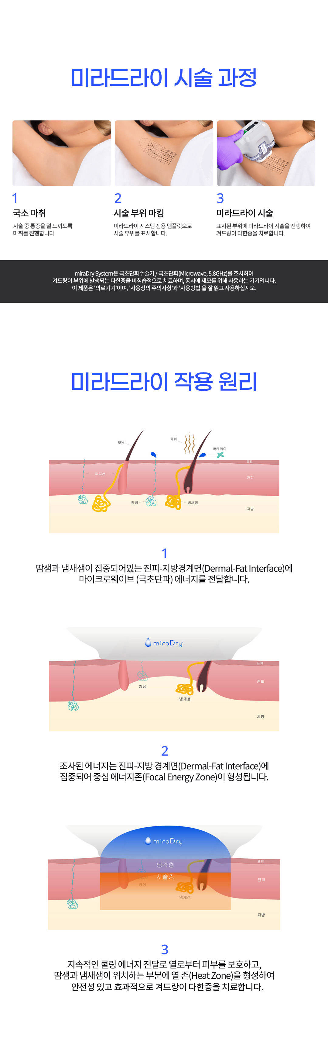 뉴 미라드라이 프레쉬는 겨드랑이땀으로 인한 다한증, 액취증을 개선하는 극초단파 기기입니다.

허쉬성형외과는 미라드라이 에너지 레벨의 최대치인 LEVEL 5로 1회 시술 시 충분한 에너지가 전달될 수 있도록 시술하고 있습니다.