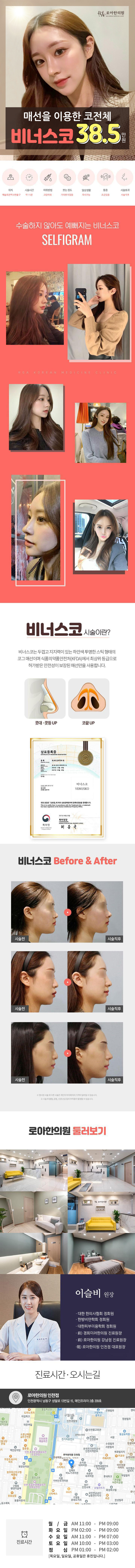 매선을 이용한 비너스코, 낮은코, 매부리코, 비절개, 넓은코, 복코, 코끝처짐
