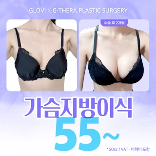 진짜 가슴 지방이식