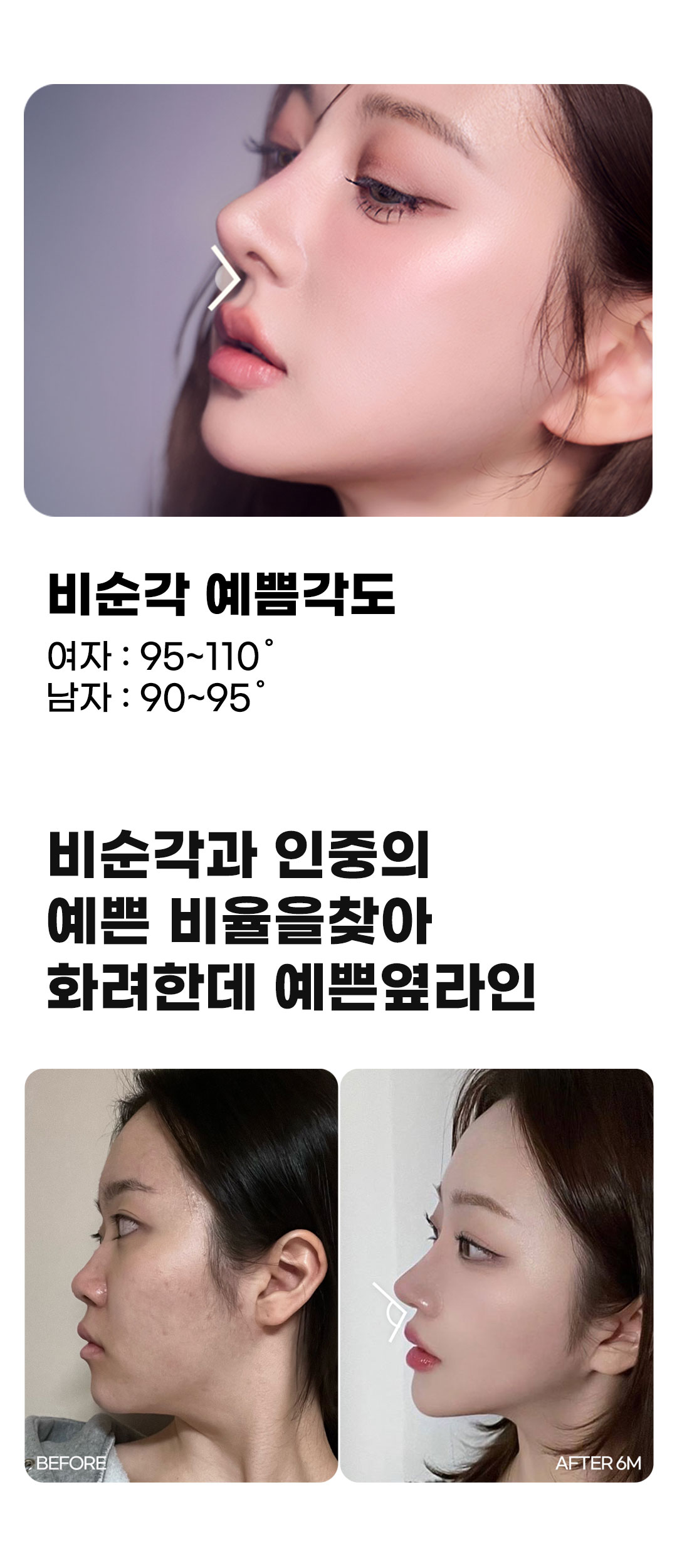 자연스럽고 화려한 코라인, 맞춤 디자인과 자가연골 사용으로 자연스럽고 화려한 예쁜 코라인을 완성