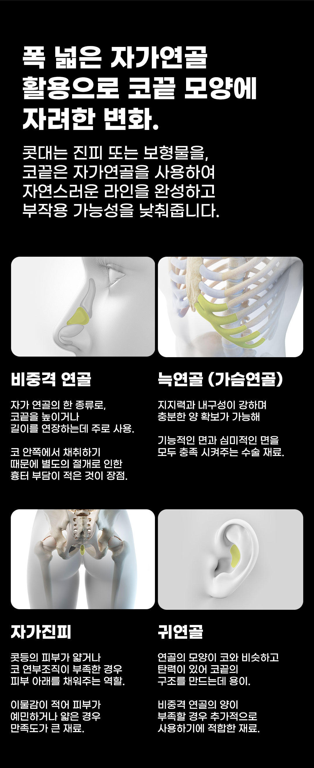 자연스럽고 화려한 코라인, 맞춤 디자인과 자가연골 사용으로 자연스럽고 화려한 예쁜 코라인을 완성