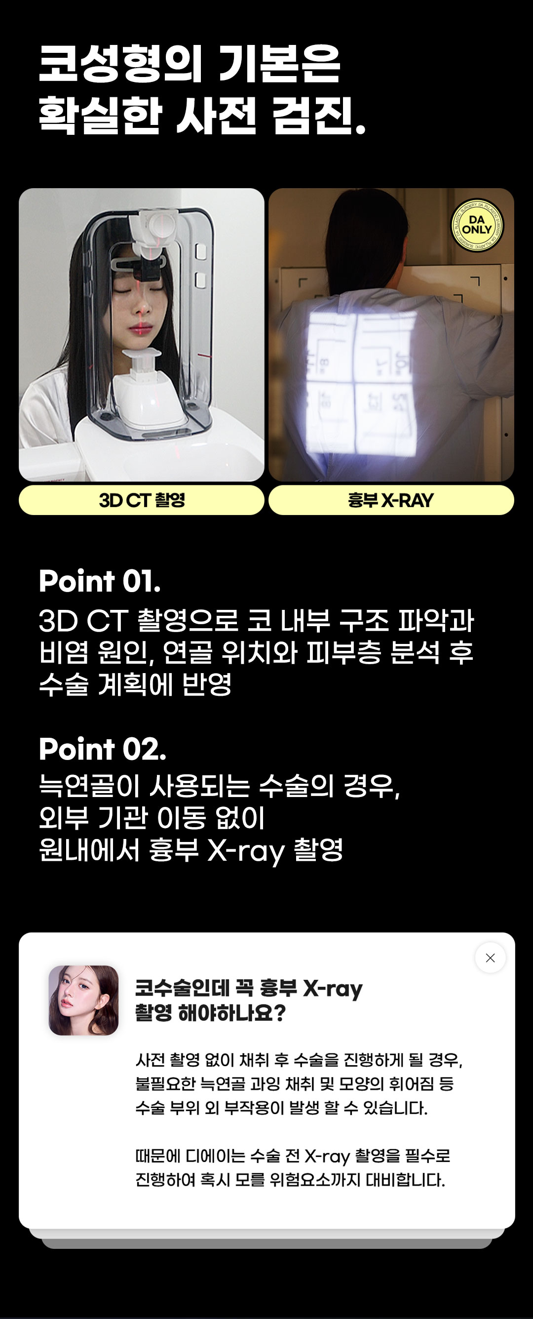 자연스럽고 화려한 코라인, 맞춤 디자인과 자가연골 사용으로 자연스럽고 화려한 예쁜 코라인을 완성