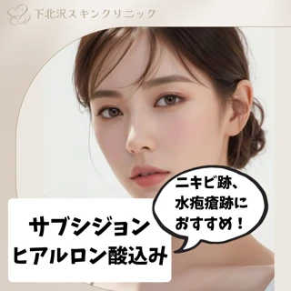 【オープン記念・モニター急募】サブシジョン(麻酔代込み)ニキビ跡、水疱瘡跡 1cm×1cm~ ヒアルロン酸込み(0.1cc~)