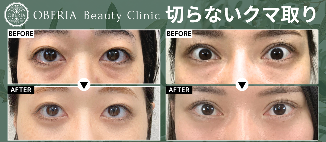 乾燥にがだま　クマ クマ柄ニットセーター - エクリュ | ZARA Japan / 日本