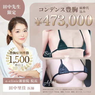 【大手美容外科出身女医執刀】コンデンス豊胸(脂肪注入豊胸)|麻酔代込み 【当日施術不可】