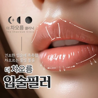 더차오름 입술필러
