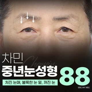 차민 중년눈성형