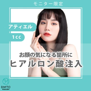 【モニター】ヒアルロン酸注入|アティエル1cc|お顔の好きな箇所に◎