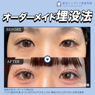 東京シンデレラ美容外科池袋院の口コミ・料金 | Unni（カンナムオンニ）