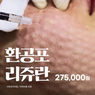 환공포 리쥬란힐러