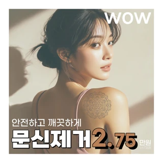 WOW 문신제거