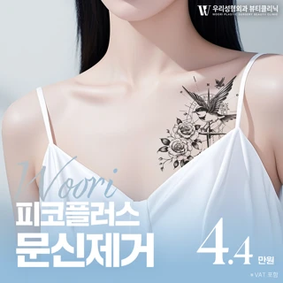 우리 피코플러스 문신제거