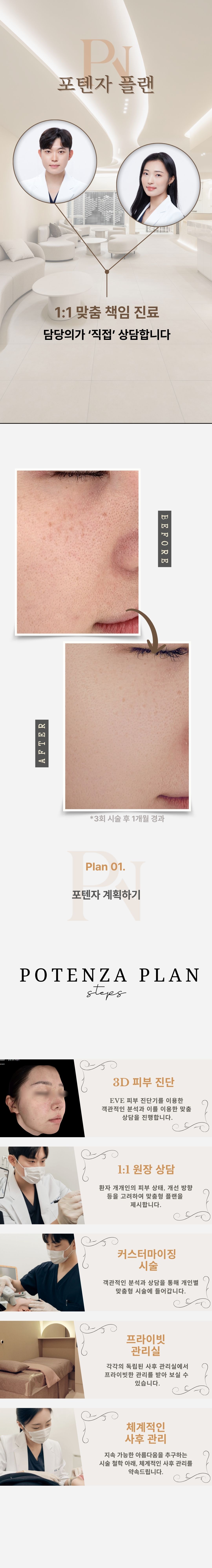 진피층에 고주파(RF) 에너지를 전달하여 조직을 응고시키는 시술로
모공 축소, 여드름, 흉터, 잔주름 개선, 피부 탄력 향상 등 다양한 효과