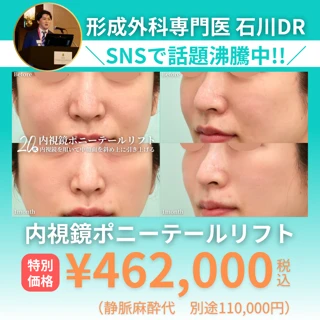 【特別価格】SNSで話題沸騰中_石川Drの内視鏡ポニーテールリフト（切らない）
