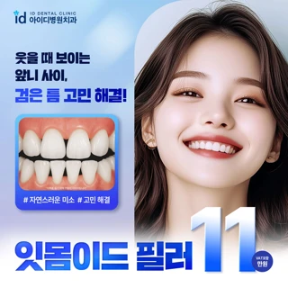  id만의 잇몸필러 잇몸이드 필러