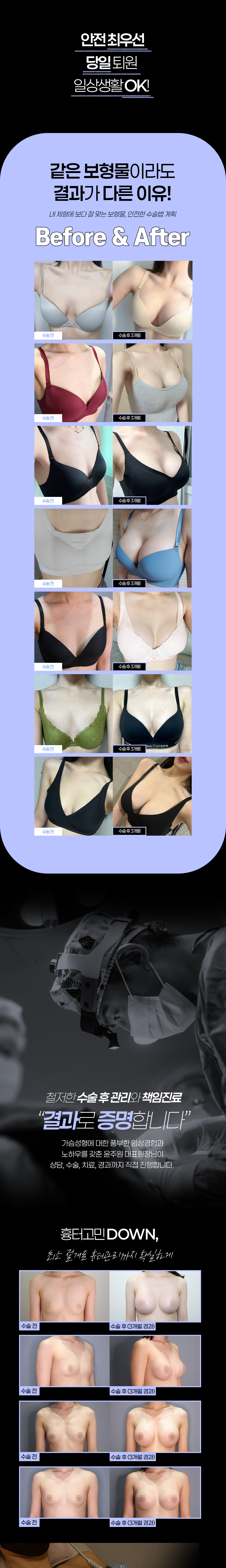 수많은 후기가 증명한 실력, 수술 전 유방검진·치료부터 보형물 검진까지, 안전까지 책임지는 RENOVO 가슴성형