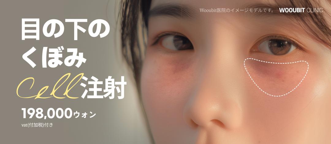 目の下のくぼみcell注射_ジュベルック＆自己血幹細胞 | wooubit医院