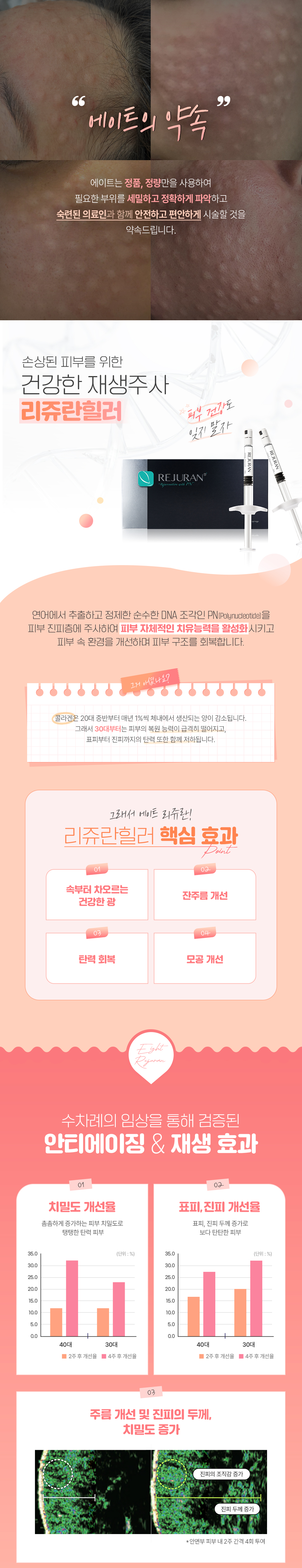 통증없는 무한광채&피부장벽강화_수면리쥬란힐러&릴리이드