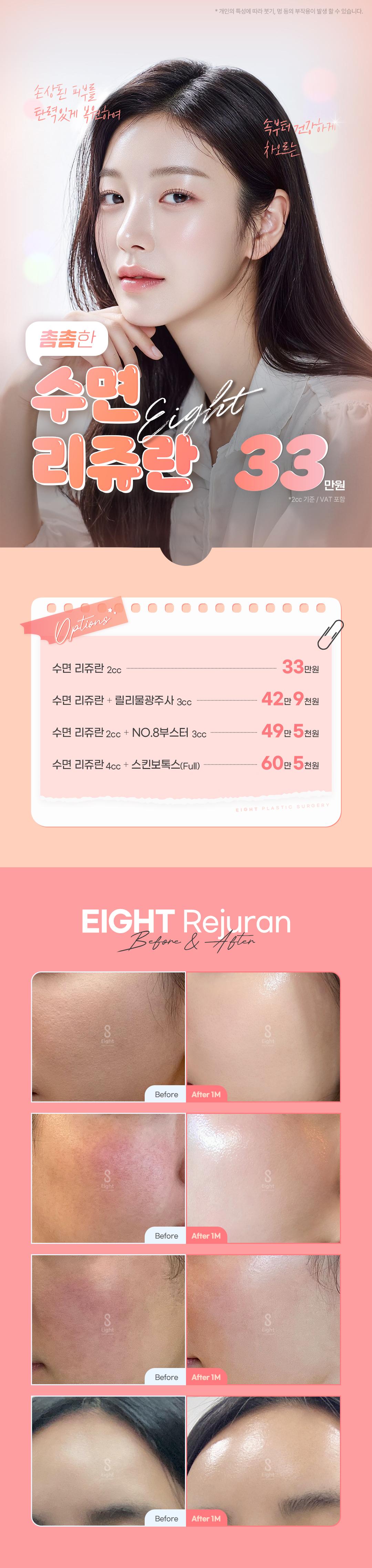 통증없는 무한광채&피부장벽강화_수면리쥬란힐러&릴리이드