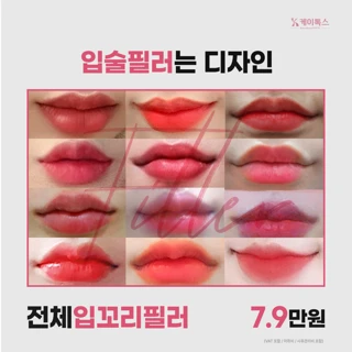 전체 입꼬리 입술필러 