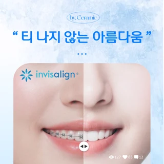 세계적인 투명교정, 인비절라인