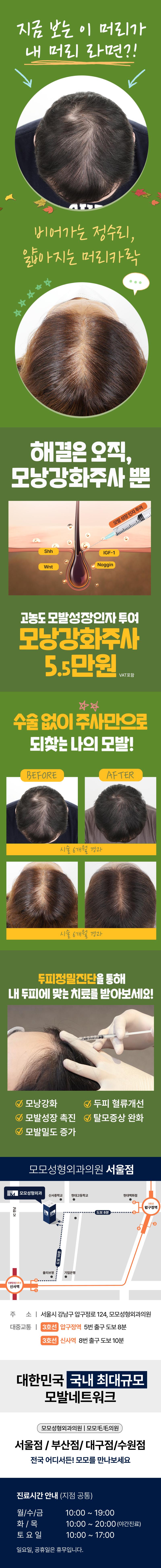 수술은 두렵지만 탈모는 걱정이신 분들에게 추천하는 수술 없이 튼튼한 모발을 만드는 모모 만의 탈모치료 방법! 모낭강화주사 입니다.
