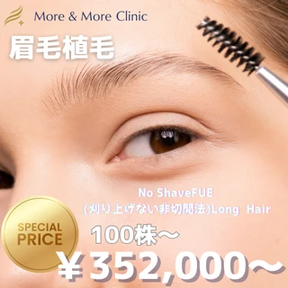 東京・麻布十番で韓国江南級植毛！Dr.ホの無剃毛Long Hair眉毛植毛＆ヘアライン矯正が韓国価格で可能！