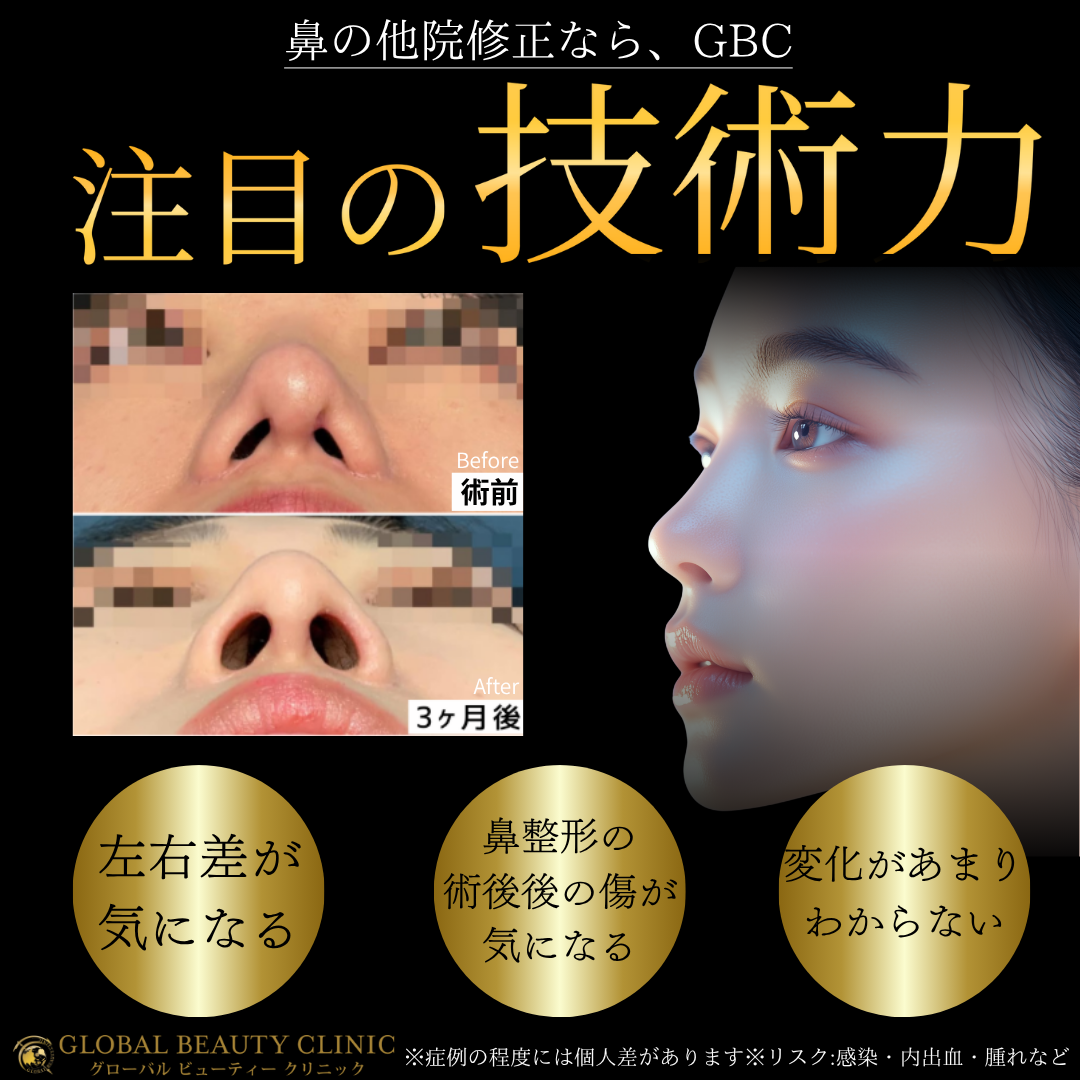 鼻の先が丸い 評価の高い順 おすすめクリニック・値段の比較(2025) | カンナムオンニ, image size:1080x1080