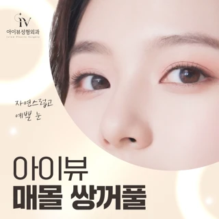 아이뷰 매몰 쌍꺼풀 이벤트