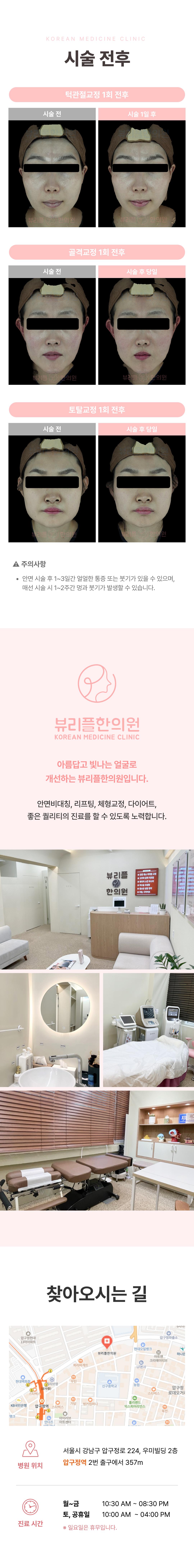 뷰리플한의원 안면비대칭 교정은 머리뼈, 얼굴뼈와 피부의 상태를 3D 메타뷰 입체사진 촬영을 통해 종합적으로 진단하고, 척추의 구조적 문제를 함께 개선하며 시술합니다.
시술은 해머링 기법, 파동테라피를 활용한 골격 교정과 수기요법, 밸런스건 요법이 함께 진행되며, 필요 시 근육의 과긴장을 완화시키고 약한 근육의 기능을 회복시키는 침치료와 물리치료를 병행합니다.
시술로 턱각라인 개선, 광대 벌어짐 완화, 눈썹 콧대 입술 비대칭 개선, 턱 벌어짐 감소, 앞볼꺼짐 개선, 얼굴 입체감 개선, 얼굴 축소 등의 효과를 얻을 수 있습니다.
